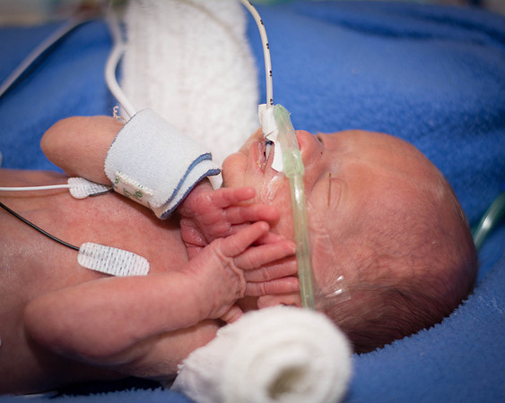 Baby's First Days of Life